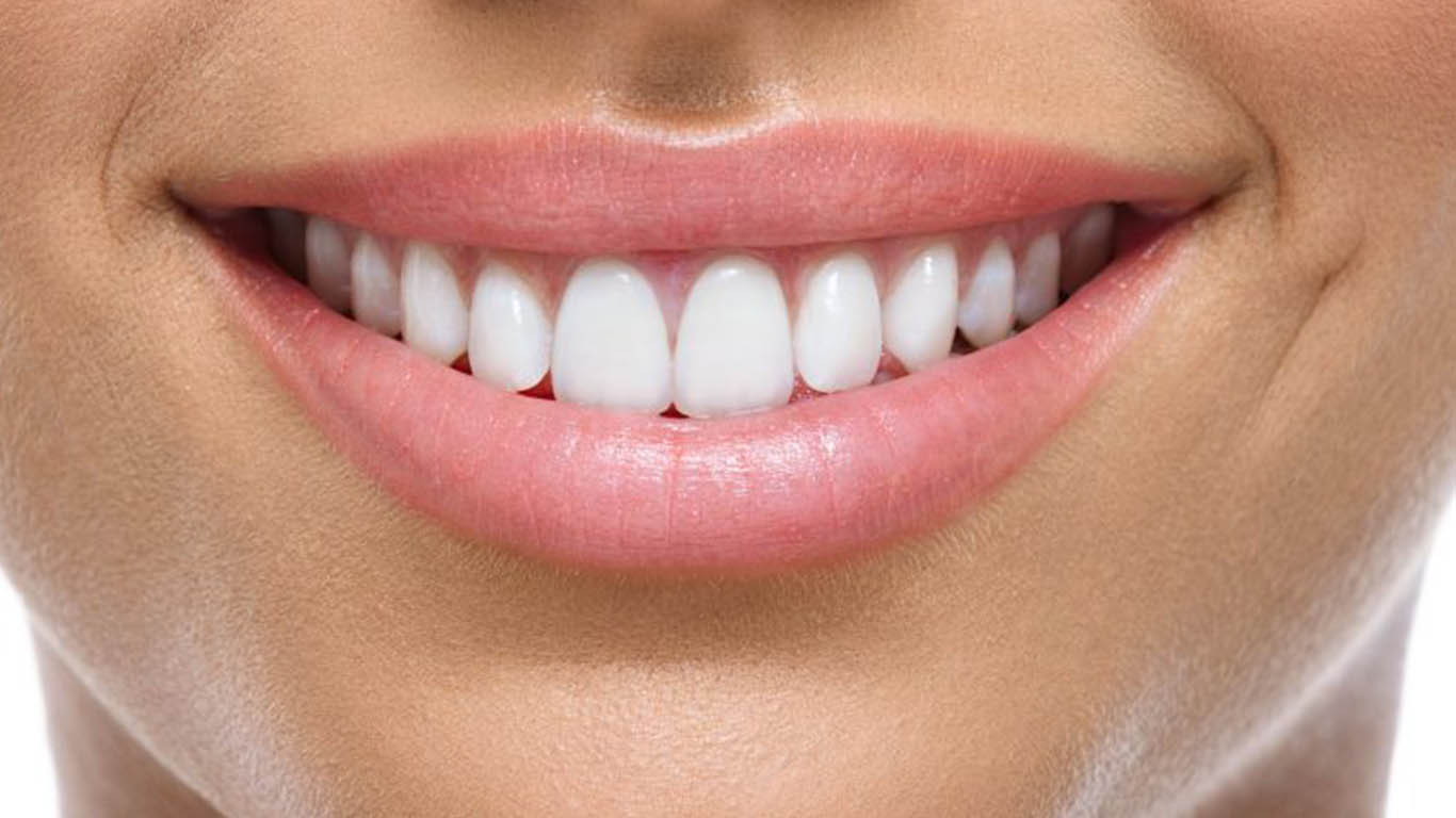 Smile Designing in Meerut